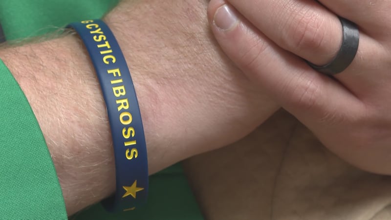 Luke Roberts wears a cystic fibrosis wristband for his 10-month-old son Hudson.